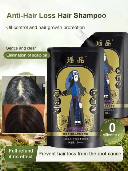 Ginger Plant Extract Anti-Hair Loss Hair Shampoo✨ BUY 1 GET 2 FREE