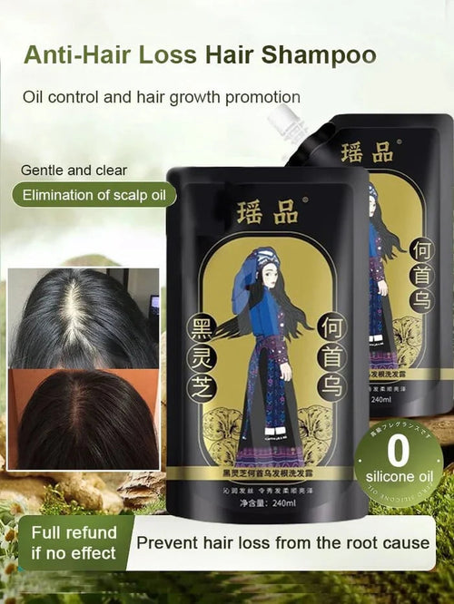 Ginger Plant Extract Anti-Hair Loss Hair Shampoo✨ BUY 1 GET 2 FREE