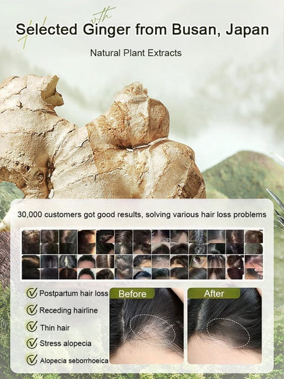 Ginger Plant Extract Anti-Hair Loss Hair Shampoo✨ BUY 1 GET 2 FREE